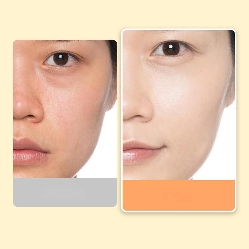 Prima e dopo trattamento viso: pelle liscia e luminosa, riduzione pori e imperfezioni. Cura della pelle, miglioramento carnagione, skincare efficace.