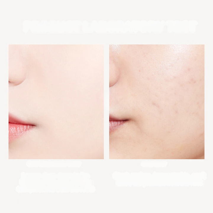 Confronto pelle viso: a sinistra pelle liscia e chiara, a destra pelle con imperfezioni e pori visibili. Risultati trattamento skincare.