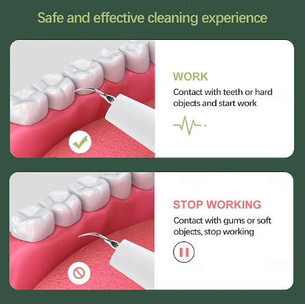 Dentora | Dispositivo professionale per la rimozione del tartaro a ultrasuoni per un&