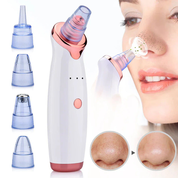 Strumento per Punti e Acne Pulizia Viso - Vesarelli