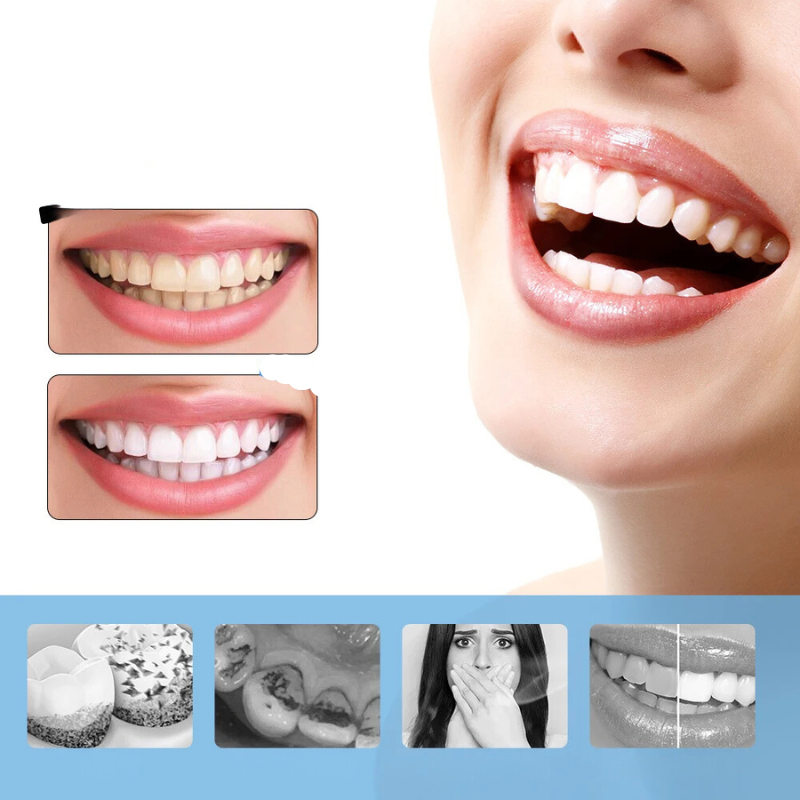 Sorriso luminoso con denti bianchi e sani, confronto prima e dopo trattamento sbiancante dentale. Cura dentale, estetica dentale, igiene orale.